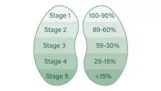 Chart of kidneys showing the percentage of kidney function for each stage of CKD, where stage 1 is 100 to 90 percent, and stage 5 is less than 15 percent
