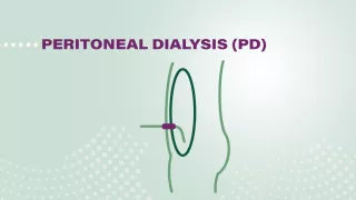 Cartoon representation of peritoneal dialysis, with text saying peritoneal dialysis (PD)