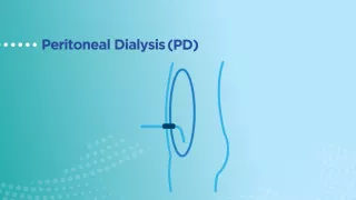 PD
