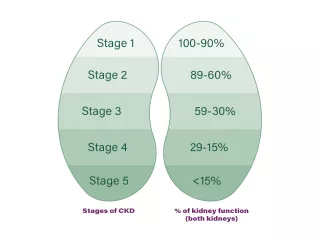 Chart of kidneys showing the percentage of kidney function for each stage of CKD, where stage 1 is 100 to 90 percent, and stage 5 is less than 15 percent