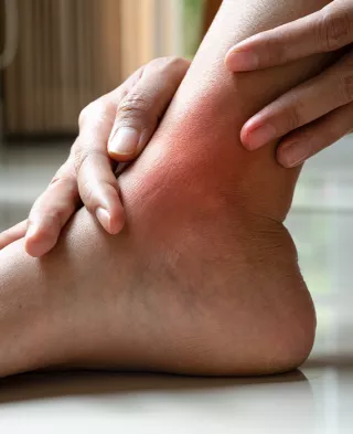 Woman's hands holding swollen ankle