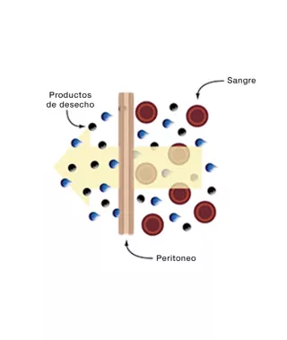peritoneal waste
