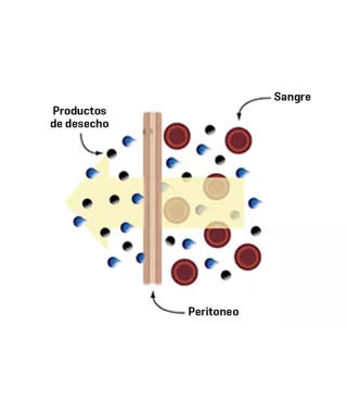 peritoneal_waste